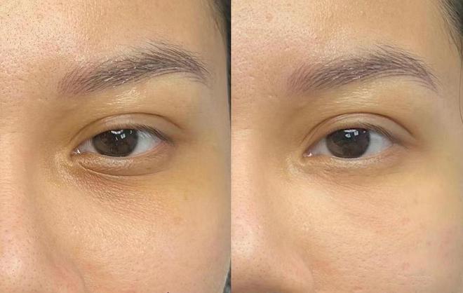 ？红榜抗初老眼霜已曝光放心进来避雷AG旗舰厅平台什么眼霜去皱效果好(图5)
