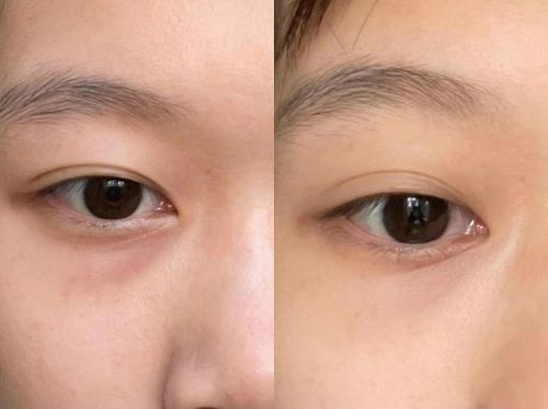 强！25年高口碑眼霜分享最新排行榜单AG旗舰厅app抗皱眼霜排行榜前十