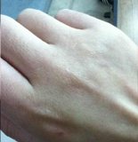 的脸第十期:秋冬护手困扰AG旗舰厅ios版救救我(图4) 的脸第十期:秋冬护手困扰AG旗舰厅ios版救救我(图4)